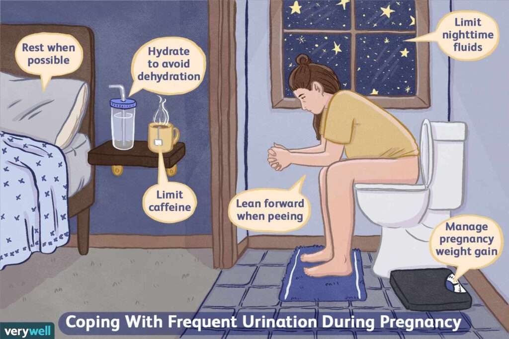 pogosto uriniranje
