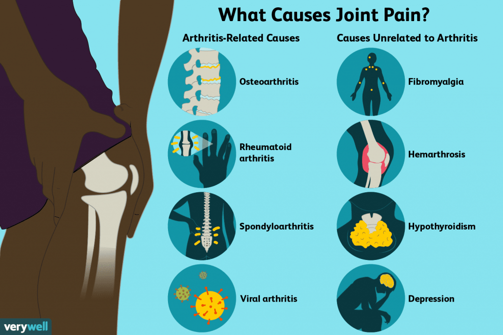 Kas ir locītavu sāpes?